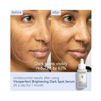 Caudalie Vinoperfect Brightening Dark Spot Serum – Radiance & Even Skin Tone